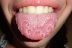 new-ai-model-identifies-diseases-with-accuracy-using-tongue-scans-credit-geographictonguejpg-wikimedia-commons-cc-by-sa-3-1