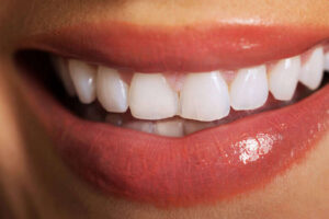 Close up on woman white teeth