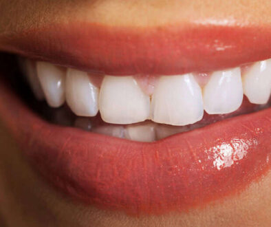 Close up on woman white teeth