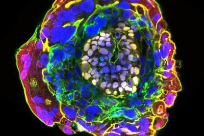 d9faeeef3a02f2a53f93ca40d1914dd93c0d85b7