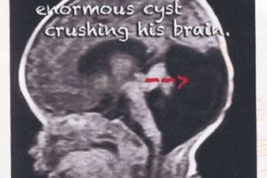 fuckcancer