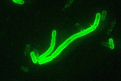 Yersinia_pestis_fluorescent