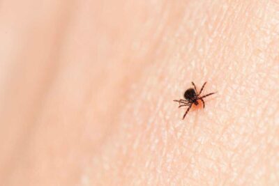 Why Ticks and Lyme Disease Are Soaring This Summer 