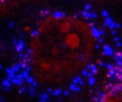 400xMicrographShowingBlueMicroplasticsInCell