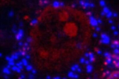 400xMicrographShowingBlueMicroplasticsInCell