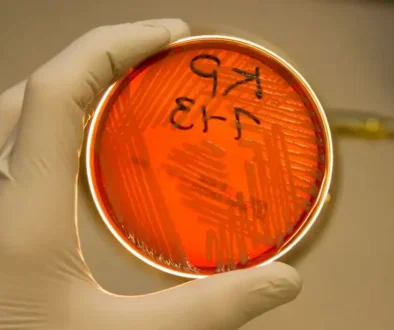 Klebsiella-pneumoniae