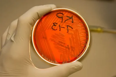 Klebsiella-pneumoniae