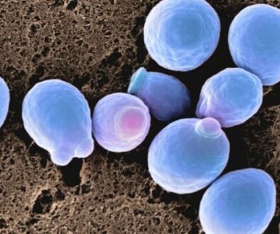 candida_cells_header-642x361-1