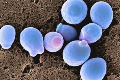candida_cells_header-642x361-1