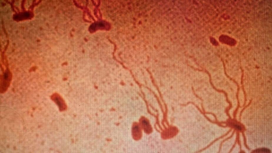 the use of smallpox as a weapon in the indian wars