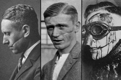 Mensur: Rare Photos of Germany’s Sword-Dueling Tradition Where Facial Scars Meant Honor – Rare Historical Photos