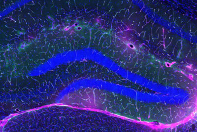 Exercise Protects Against Alzheimers, And Scientists May Finally Know Why : ScienceAlert