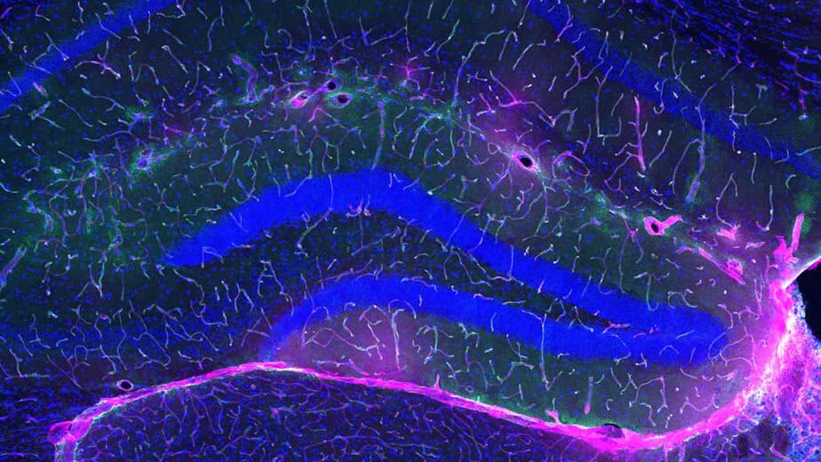 Exercise Protects Against Alzheimers, And Scientists May Finally Know Why : ScienceAlert