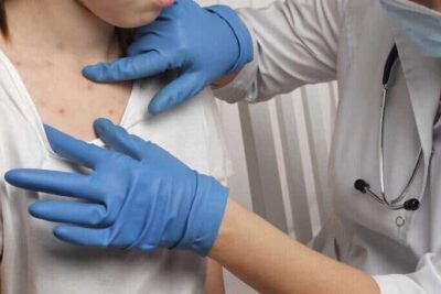 We study pandemics, and the resurgence of measles is a grim sign of what’s coming