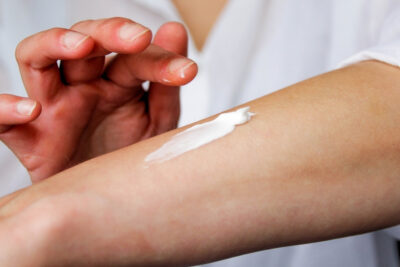 Scientists Uncover The Nerve Pathway That Makes Stress Worsen Eczema : ScienceAlert