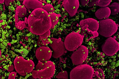 Viruses That Jump to Humans Dont Need Special Mutations, Study Finds : ScienceAlert