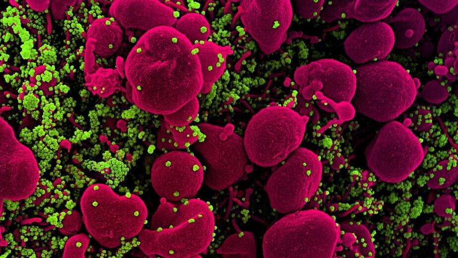 Viruses That Jump to Humans Dont Need Special Mutations, Study Finds : ScienceAlert
