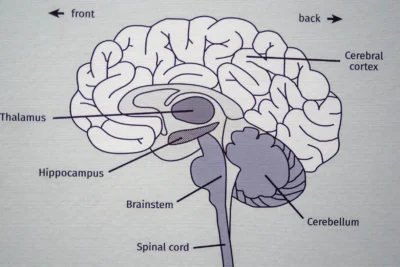 Study Reveals the Single Cause of Cognitive Decline—and a Cure