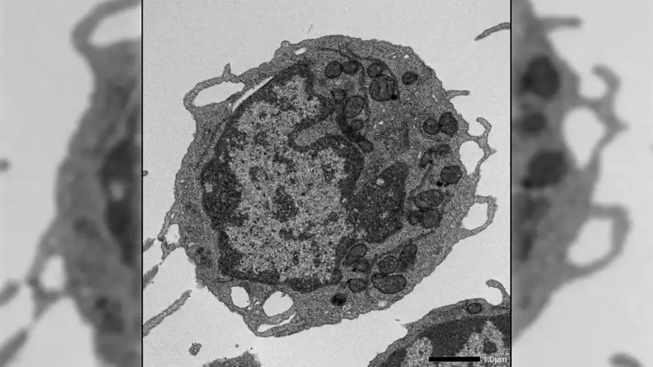 A “death” protein may be the key to slowing aging at its source