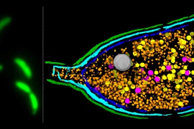 Scientists discover bacteria can “explode” to spread antibiotic resistance