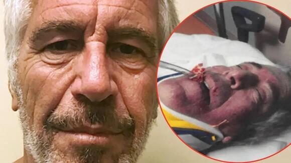 ‘This Is a Cover-Up’: Jeffrey Epstein’s Brother Exposes Eerie Details About Vile Pedo’s Death Behind Bars During Shocking Nancy Grace Interview
