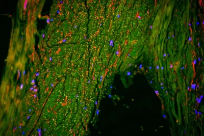 Scientists just found a hidden “drain” inside the human brain