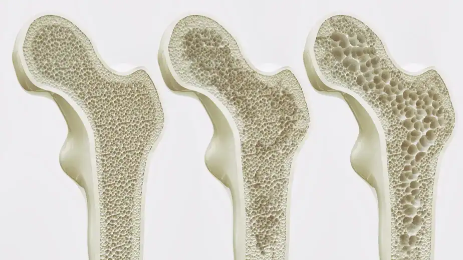 Scientists may have found a way to keep your bones strong for life