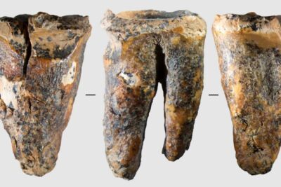 Neanderthals drilled cavities to treat a toothache 59,000 years ago