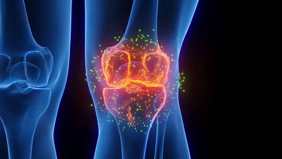 This ultrasound treatment may help stop arthritis before it starts