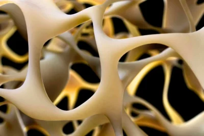 Breakthrough to Make Bones Stronger Could Reverse Osteoporosis
