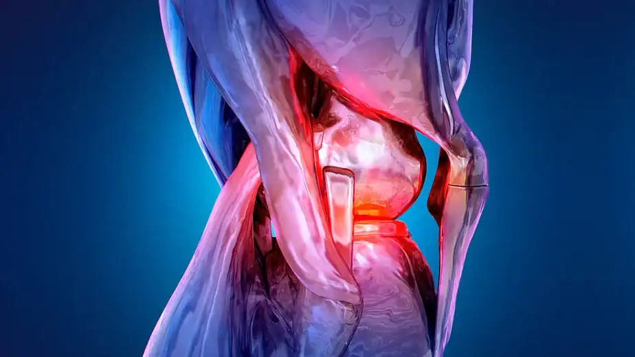 Non-Surgical Procedure Halves Knee Pain Over 12-Month Trial