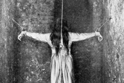 25 Photos Of 1800s Medical Horrors That Made My Jaw Drop