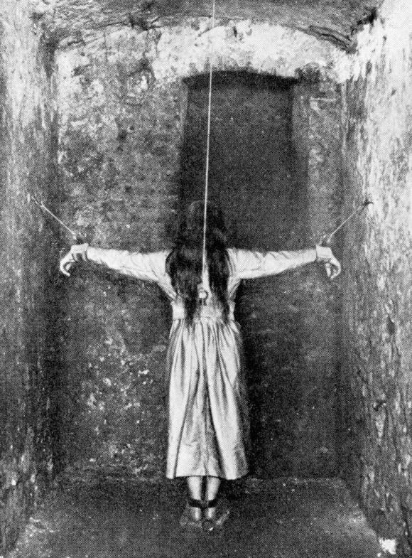 25 Photos Of 1800s Medical Horrors That Made My Jaw Drop