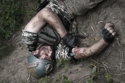 This spray-on powder can stop life-threatening bleeding in 1 second