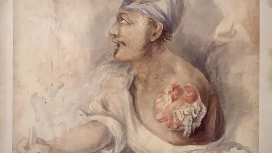 A War of 1812 soldier buried his own arm. His real story is even stranger